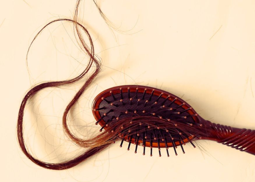  Baricitinib gegen Haarausfall Alopecia areata zugelassen 