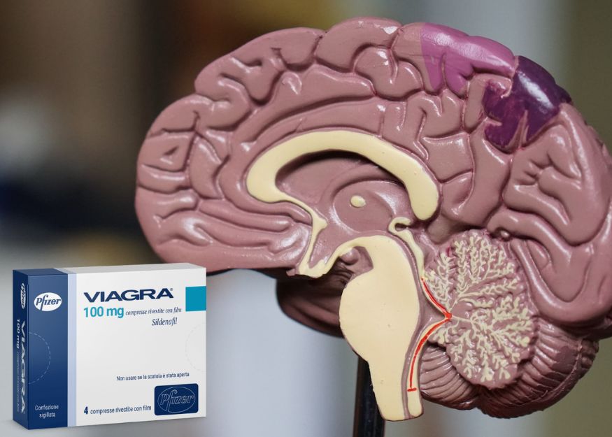 Kann Viagra gegen Alzheimer helfen?   